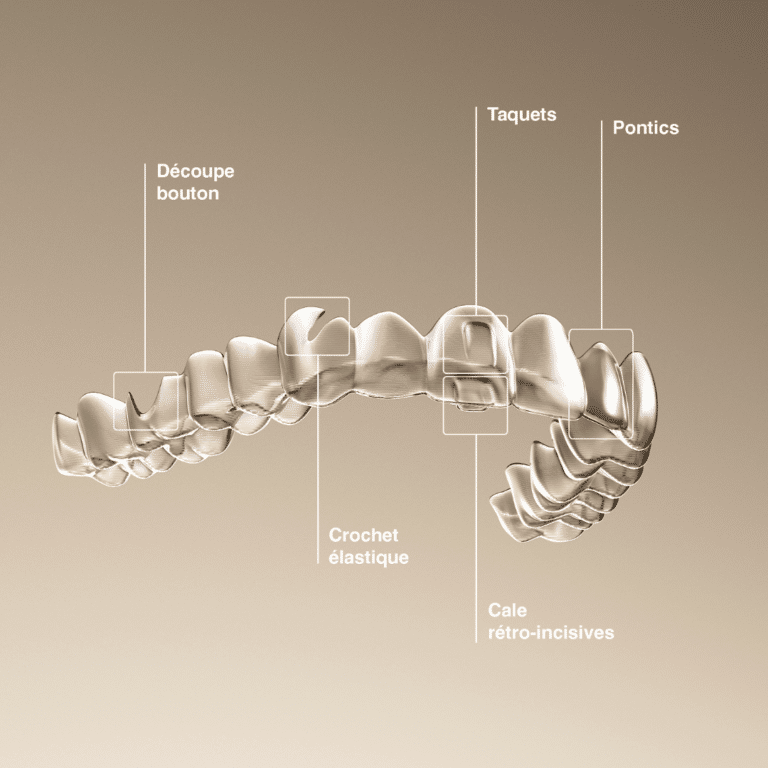Comment fonctionnent les aligneurs dentaires invisibles Aligneurs Français