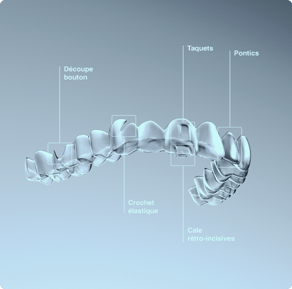 Alignement dentaire invisible par aligneurs transparents