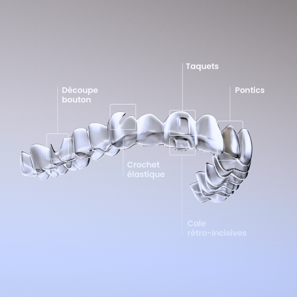 Alignement dentaire invisible par aligneurs transparents - orthodontie