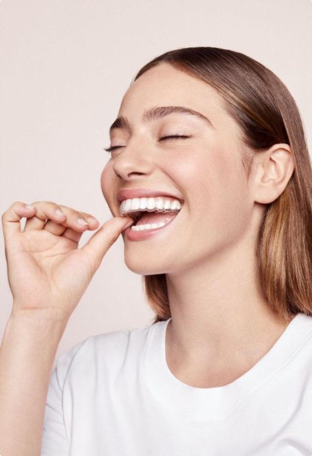 Aligner les Dents Naturellement Méthodes et Prix de l